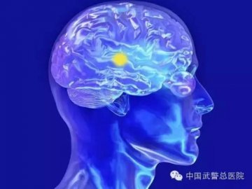 神经内科看什么病的？听听武警总医院医生怎么说