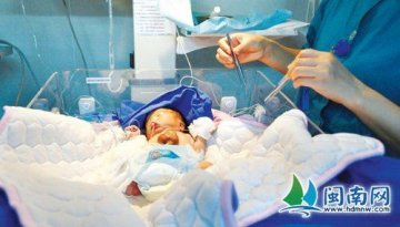 福建一产妇诞下龙凤三胞胎 老大心脏长在肚皮外