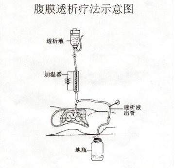 男子自制血透机透析13年 专家支招：腹膜透析可作为首选