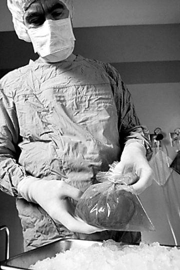 美欲允许移植被HIV感染器官