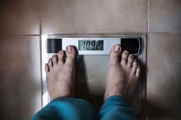 蜕变：西班牙女子手术减肥