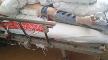 老人养老院里骨折 8万医疗费应该谁承担？