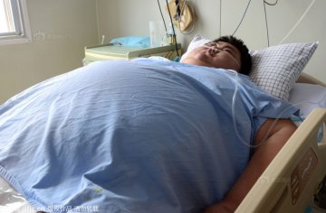 600斤重“中国首胖”抢救无效死亡