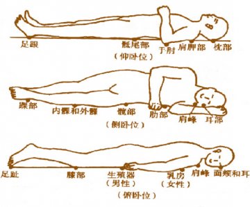 防褥疮：多维度 全方位