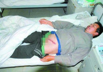 环卫工阻止乱倒垃圾遭暴打 打人者系卫生局干部