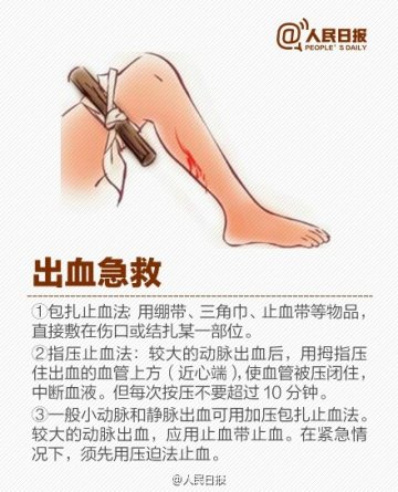 这些急救知识你应该知道