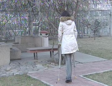 女子花费十万元断骨增高变成残疾人