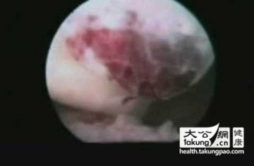 神奇的生命：实拍女性排卵真实过程