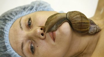 重口味医疗美容：蜗牛蟒蛇齐上身