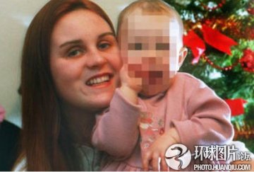 盘点：惨不忍睹的减肥后遗症