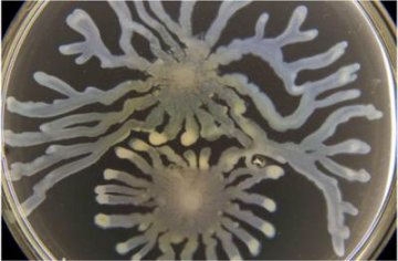 PNAS：控制细菌细胞密度可有效抵御细菌的感染