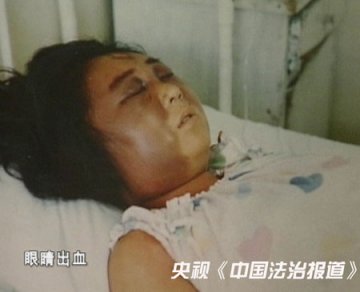 母亲认定女儿妖魔附体 将其脱光毒打致死