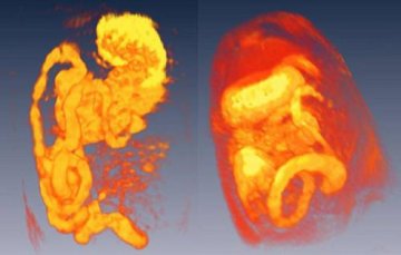 美国科学家以3D图像呈现人体内脏消化反应