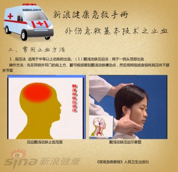 指压止血方法：颞浅动脉压迫法