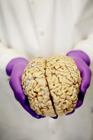 揭秘人脑解剖全过程