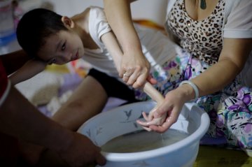 实拍尼曼皮克氏病患者的生活