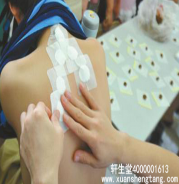 三伏贴固定敷料的选择及注意事项