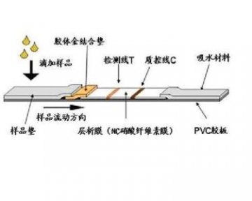 中国好军医：艾滋病检测方法