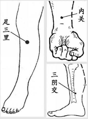 康熙下旨防控富贵病