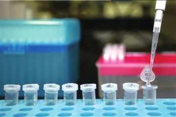中国艾滋病疫苗进入临床试验阶段 已有31人接种