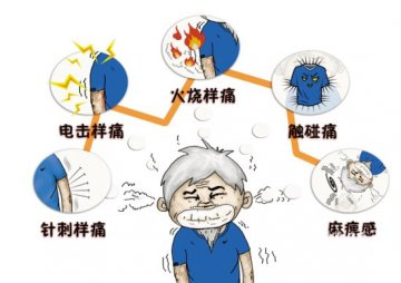 军医提醒：千万不可小看带状疱疹