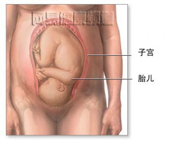 剖腹产手术图解