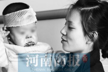 1岁半女婴患怪病 皮肤松弛似老人
