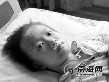 10岁女孩罹患红斑狼疮 无钱治疗生命垂危