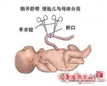 医学图解：剖腹产手术全过程