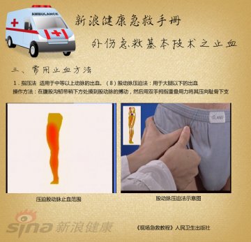 指压止血方法：股动脉压迫法