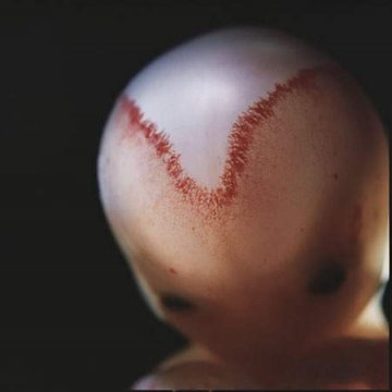 精子如何发育成胎儿