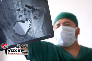 小伙肚中取出15个指甲刀30枚刀片 曾醉酒欲轻生