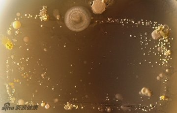 手机暗藏大量细菌 这是显微镜下的景象