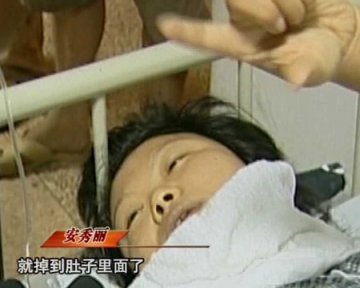 黑诊所非法引产十厘米长针穿破孕妇子宫
