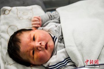 广东孕妇产下14斤重巨婴