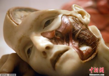 韦尔科姆收藏馆举办“人脑”展