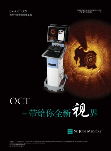 光学干涉断层成像系统-Optical Coherent Tomography Imaging System官方高清创意广
