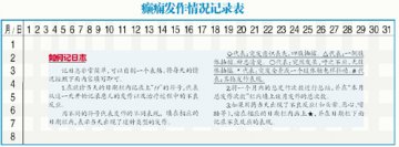 癫痫需长期治疗 七成患儿可痊愈