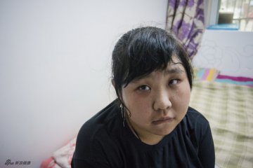 罕见病系列：白塞病女孩的故事