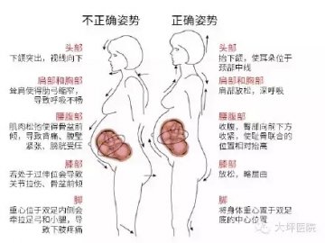 一图读懂：孕妇的正确站姿