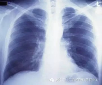 如何选择X线片、CT和磁共振检查