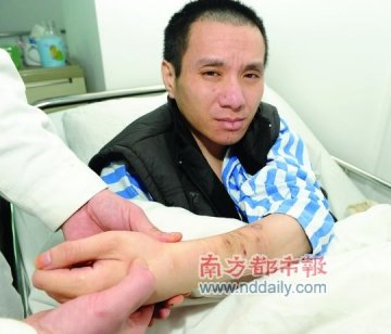 少年因暴力倾向被父母链锁17年双下肢严重萎缩