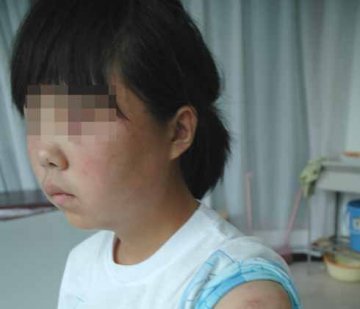 四名女生虐打残疾同学 强迫其用卫生巾止血
