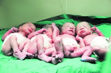 孕妇早产诞下全男四胞胎 概率为352万分之一