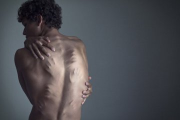 抑郁症患者的超现实自拍