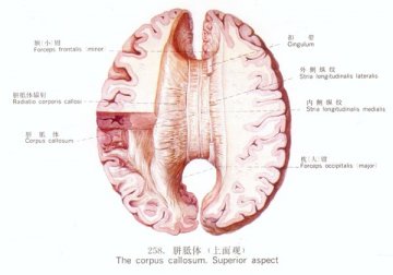 胼胝体（上面观）