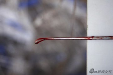 实拍少女人工流产过程
