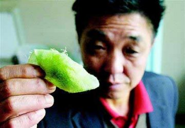 男子身上冒绿色汗渍