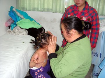 年轻妈妈割皮救女爱心感天动地 博士军医巧手首期手术圆满成功