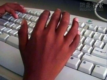 科学家发现关键基因：人类可长出六个指头